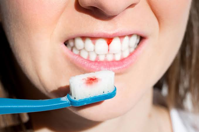 क्या आपकी दांतो मे समस्या है ? तो इसे जरूर पढ़े