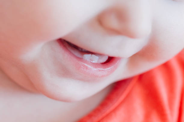 बच्चो के दांत निकलना,दंत का टूटना उसके कारण ,लक्षण एवम उपाय।